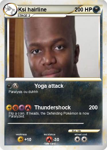 Pokemon Ksi hairline