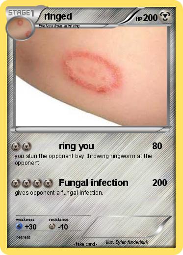 Pokemon ringed