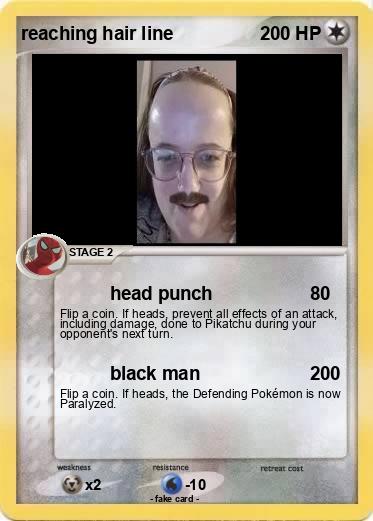 Pokemon reaching hair line