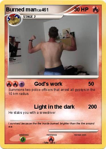Pokemon Burned man