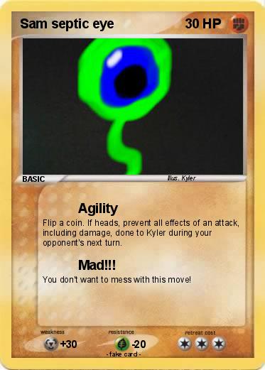 Pokemon Sam septic eye