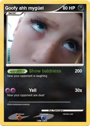 Pokemon Goofy ahh mygüel
