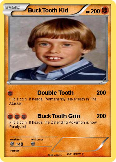 Pokemon BuckTooth Kid