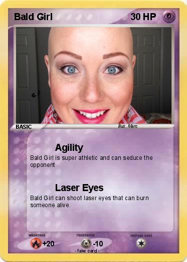 Pokemon Bald Girl