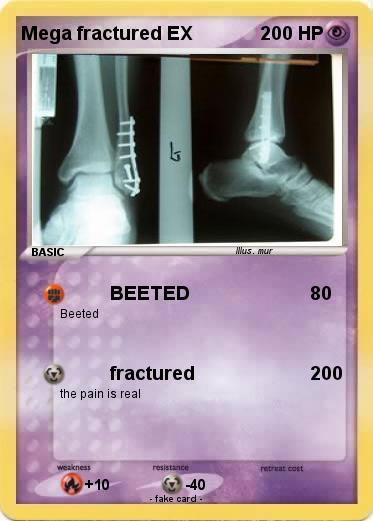 Pokemon Mega fractured EX