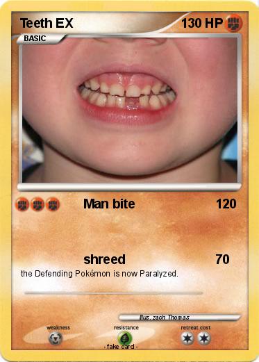 Pokemon Teeth EX