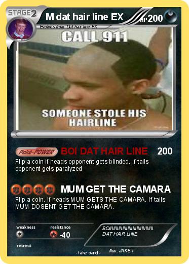 Pokemon M dat hair line EX