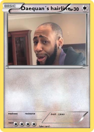 Pokemon Daequan´s hairline