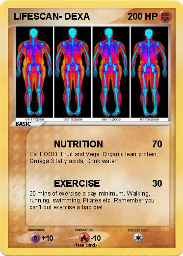 Pokemon LIFESCAN- DEXA