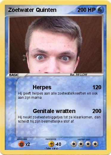 Pokemon Zoetwater Quinten