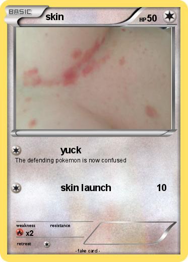 Pokemon skin