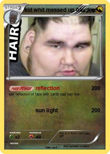 Pokemon kid whit messed up hair line