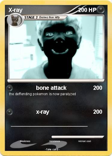 Pokemon X-ray