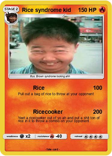 Pokemon Rice syndrome kid