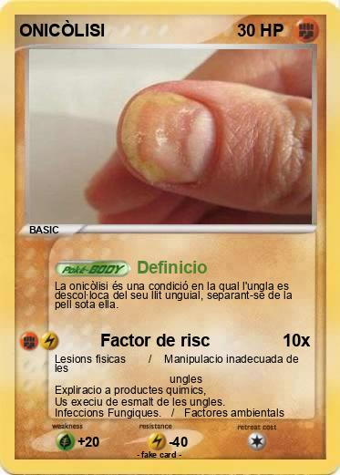 Pokemon ONICÒLISI