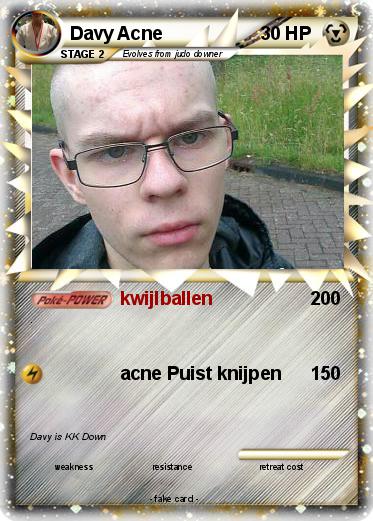 Pokemon Davy Acne