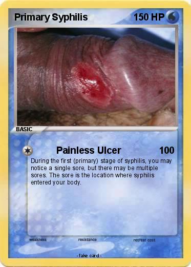 Pokemon Primary Syphilis