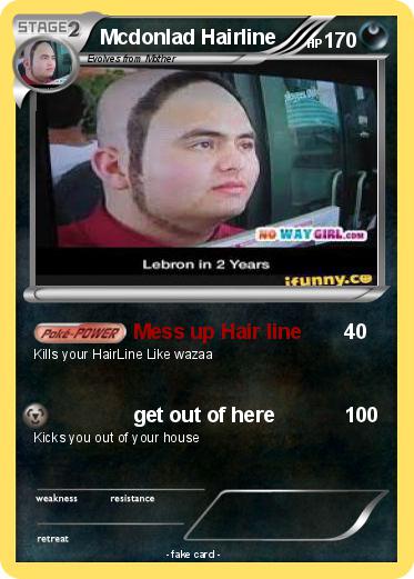 Pokemon Mcdonlad Hairline
