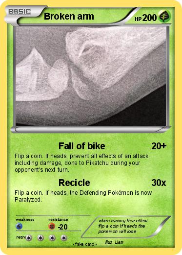 Pokemon Broken arm
