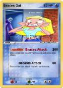 Braces Gal