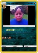 My Hairline