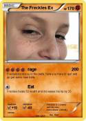 The Freckles Ex