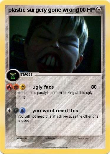 Pokemon plastic surgery gone wrong