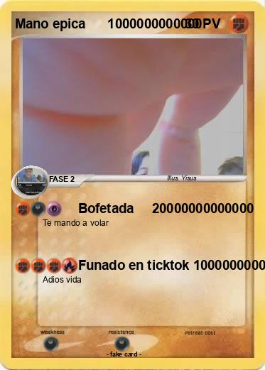 Pokemon Mano epica      1000000000000