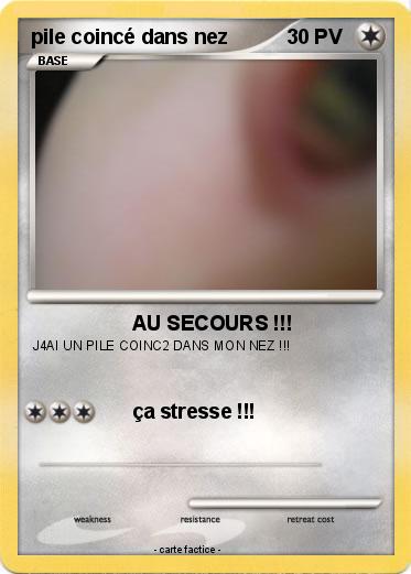 Pokemon pile coincé dans nez