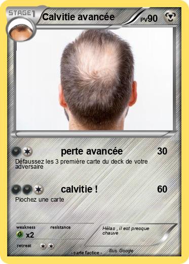 Pokemon Calvitie avancée