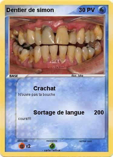 Pokemon Dentier de simon