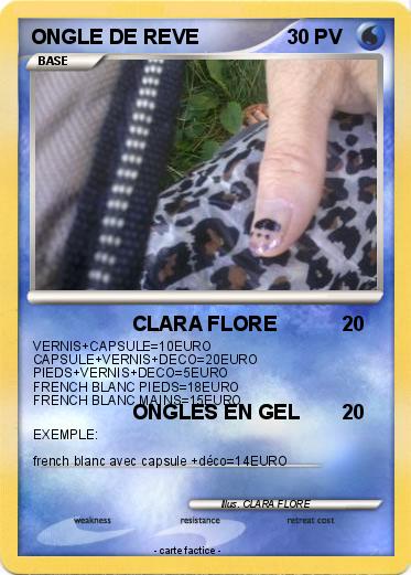 Pokemon ONGLE DE REVE