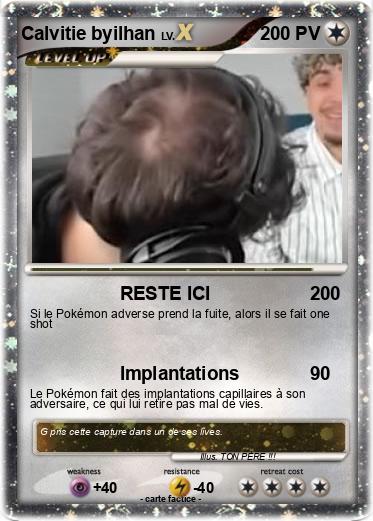 Pokemon Calvitie byilhan