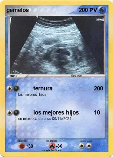 Pokemon gemelos