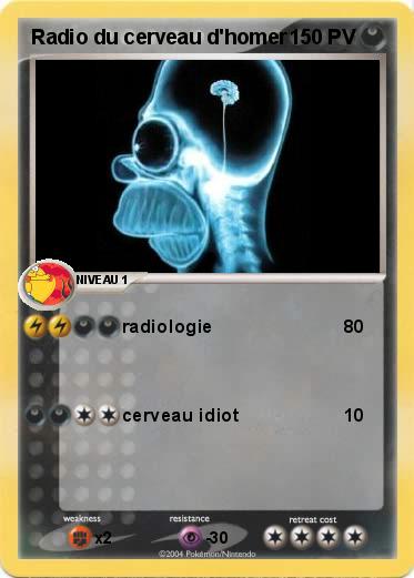 Pokemon Radio du cerveau d'homer