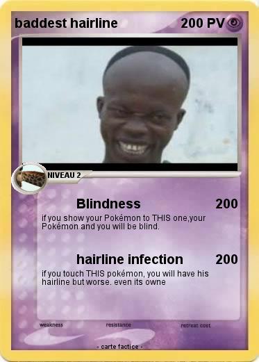 Pokemon baddest hairline