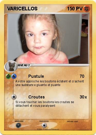Pokemon VARICELLOS