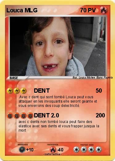 Pokemon Louca MLG