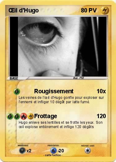 Pokemon Œil d'Hugo