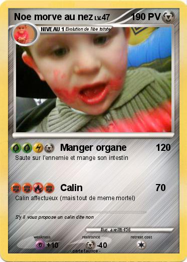 Pokemon Noe morve au nez