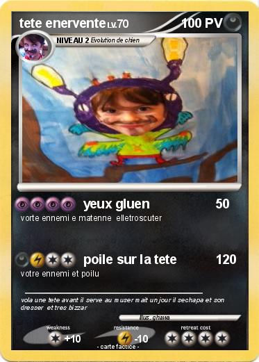 Pokemon tete enervente
