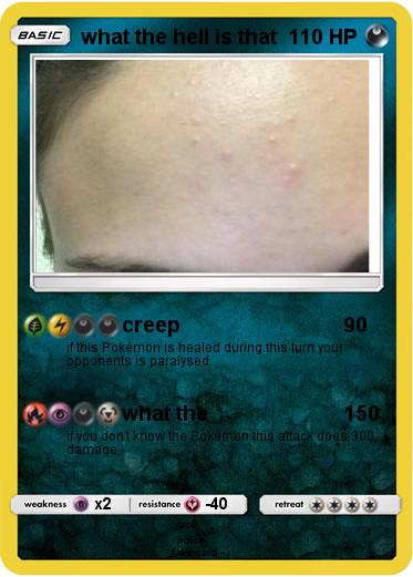 Pokemon what the hell is that