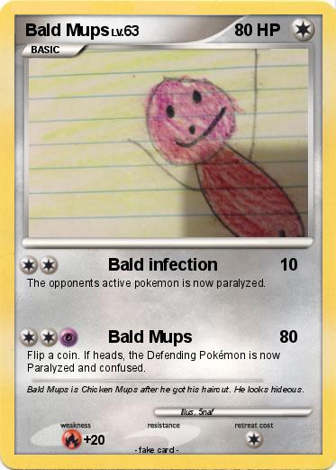 Pokemon Bald Mups