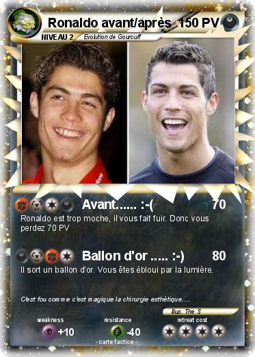 Pokemon Ronaldo avant/après