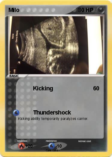 Pokemon Milo