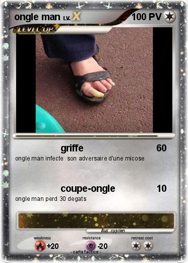 Pokemon ongle man