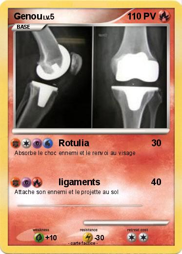Pokemon Genou