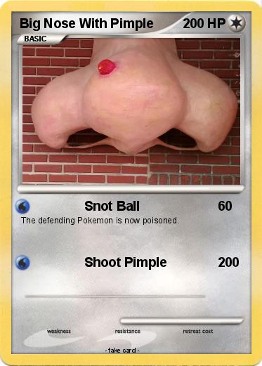 Pokemon Big Nose With Pimple