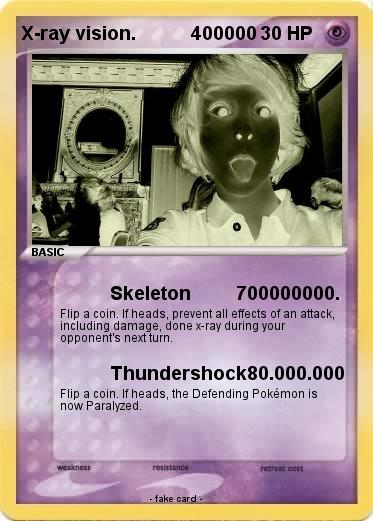 Pokemon X-ray vision.           400000