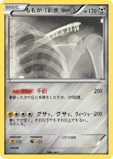 Pokemon ももか（術後 Ver.）